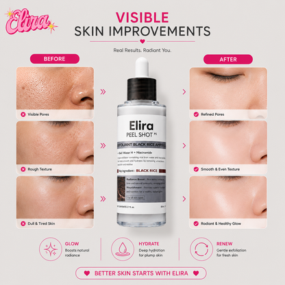 Elira Peel Shot